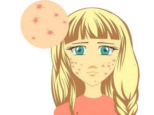 发痘痘吃瓜,揭秘痘痘与饮食的微妙关系